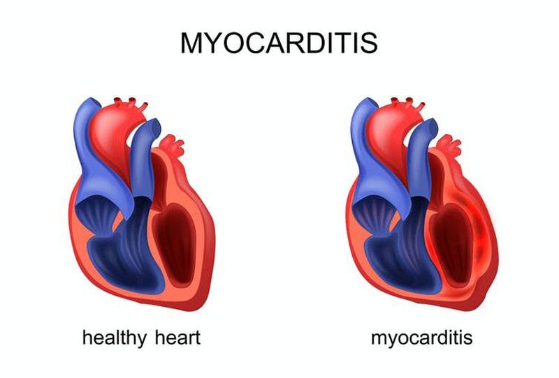چگونه می توان از سکته قلبی جلوگیری کرد درمان سکته قلبی سکته قلبی چیست علائم بروز سکته قلبی علائم حمله سکته قلبیعلائم سكته قلبي علائم سکته قلبی در زنان عوارض بعد از سکته قلبی نشانه های سکته قلبی