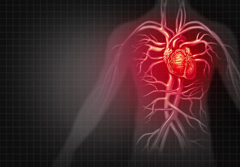 نارسایی قلبی علائم نارسایی قلبی درمان نارسایی قلبی طول عمر بیماران نارسایی قلبی انواع نارسایی قلبی نارسایی احتقانی قلب نارسایی بطن چپ نارسایی قلبی در جوانان نارسایی قلبی و تنگی نفس
